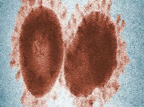 新冠病毒可能已经在人类中传播多年